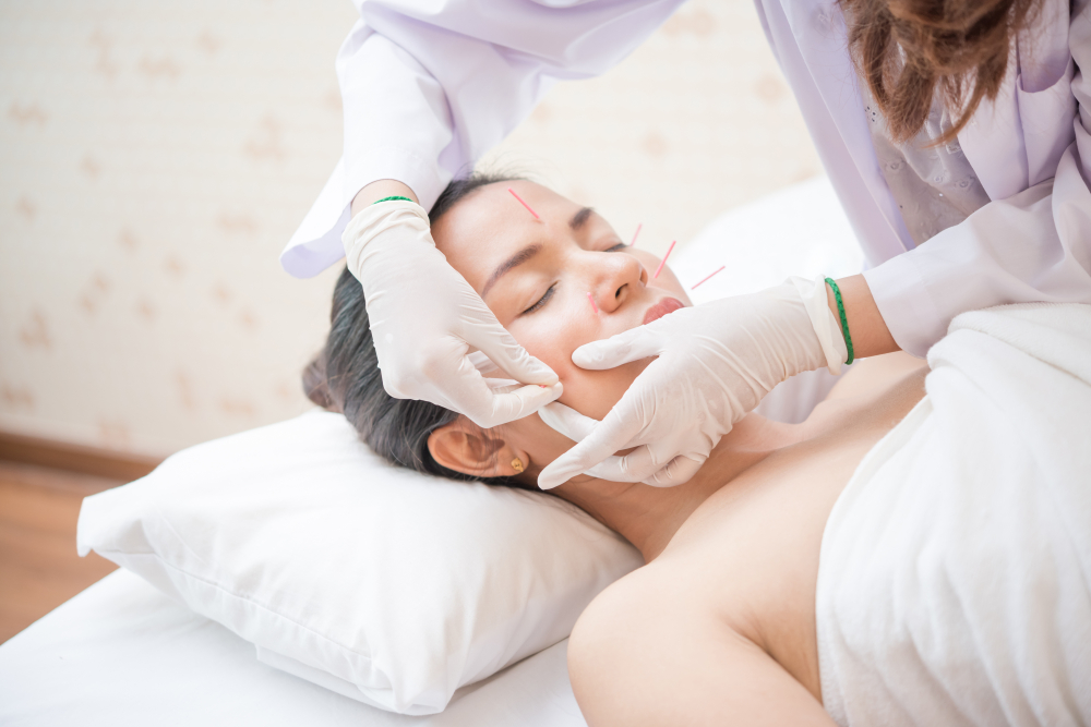 A gloved practitioner in a light purple coat using both hands to work on a woman's face, with pink acupuncture needles placed on her forehead and cheek as she rests with her eyes closed on a white treatment table.